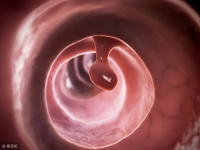 只有腸道健康，才能顯得你更年輕！