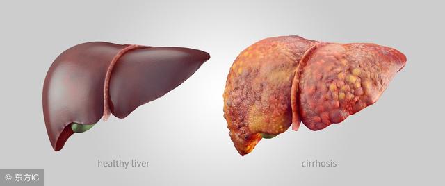 早上起床後，經常口乾口苦？ 可能暗示這5種疾病，別想得太簡單！
