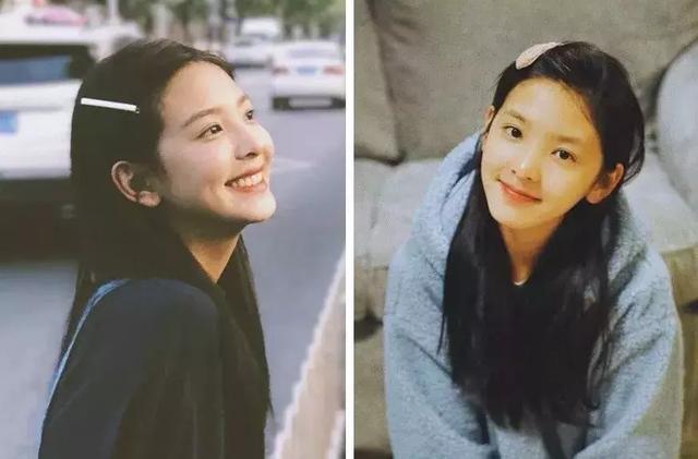 “土味發卡”重出江湖，十年前覺得土到掉渣的發卡，火遍時尚圈！