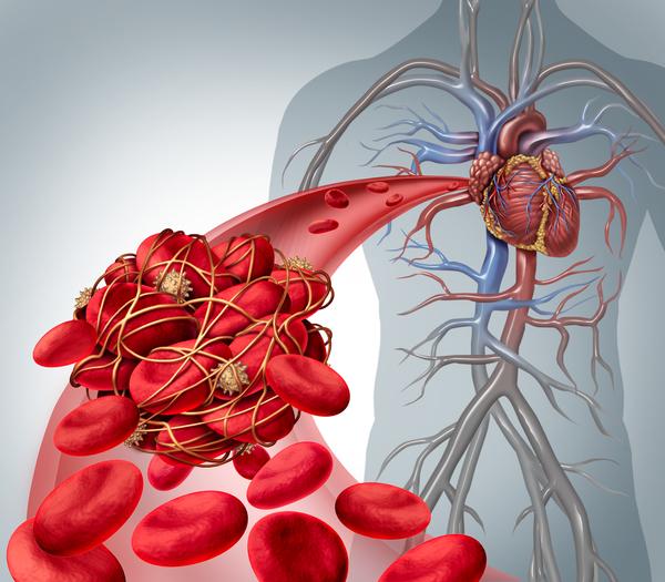 每天走多少步能夠保護血管？ 軟化血管可吃什麼？ 一文告知