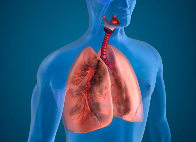說到肺炎，這8個重要的醫學常識，每個人都應該知道