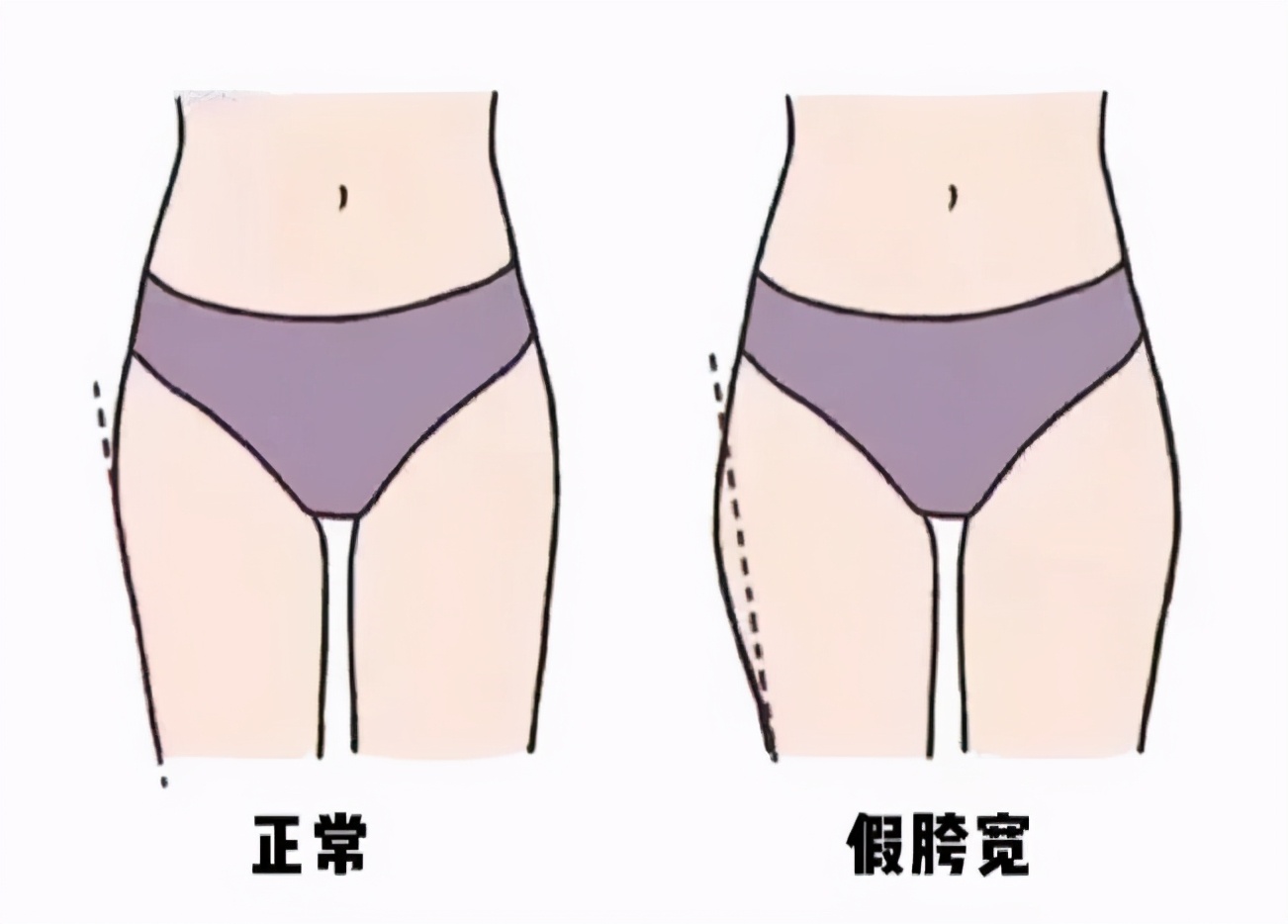 你適合穿裙子還是褲子? 看完這3點就知道了