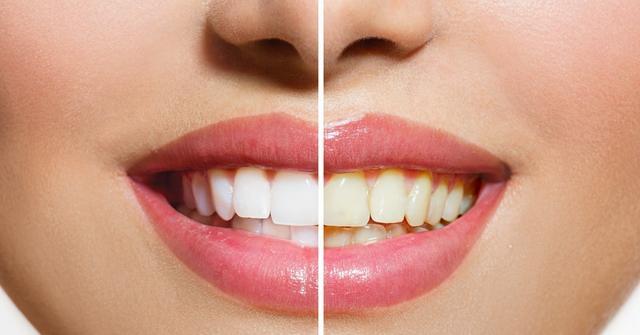 牙科醫生評出10種染色食物，越吃你的牙越黑